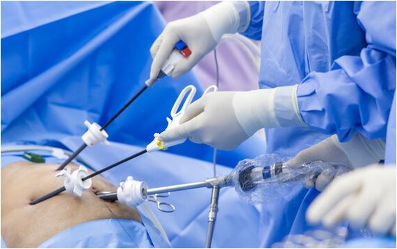 Laparoscopic surgeries