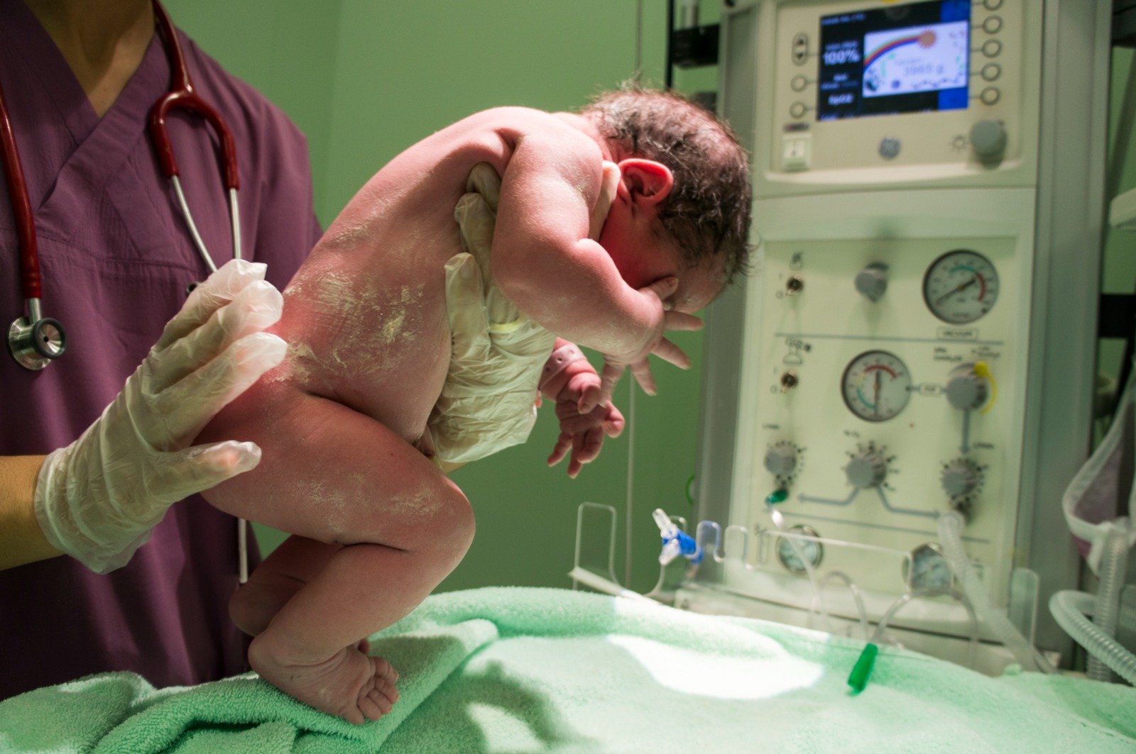 NICU